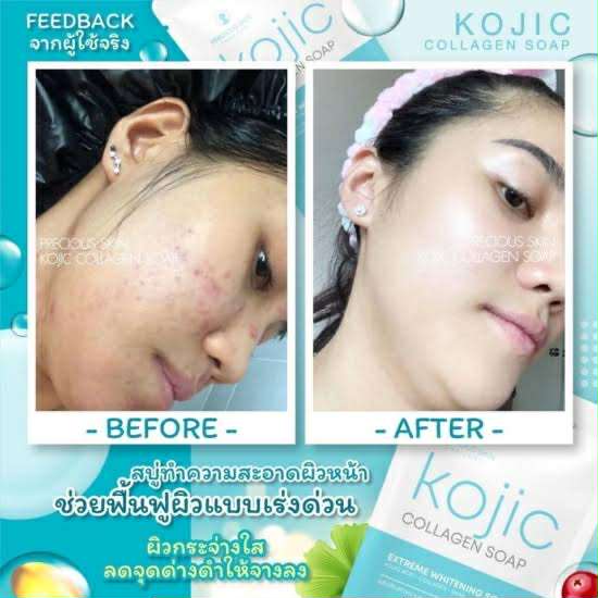 Picture of Pskins Colagen Soap - 60gm (Thailand) neew