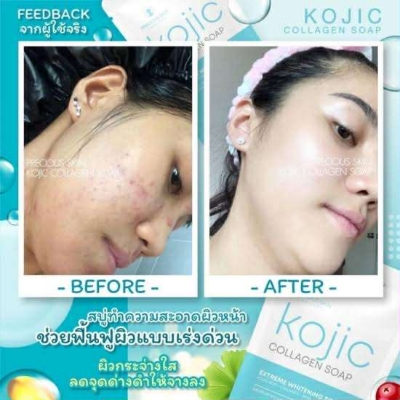 Picture of Pskins Colagen Soap - 60gm (Thailand) neew