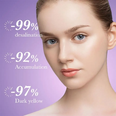 Picture of SADOER Niacinamide Whitening Freckle Cream Effectively Removes Melasma Lightens Black Spots Acne Marks Brightens Skin Care-20gm