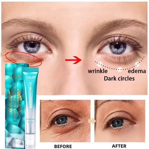 Picture of Osufi Anti Wrinkle Massage Eye Cream Reduces Eye Wrinkles Removes Bags Dark Circles Moisturizes Skin Beauty Health Eye Essen