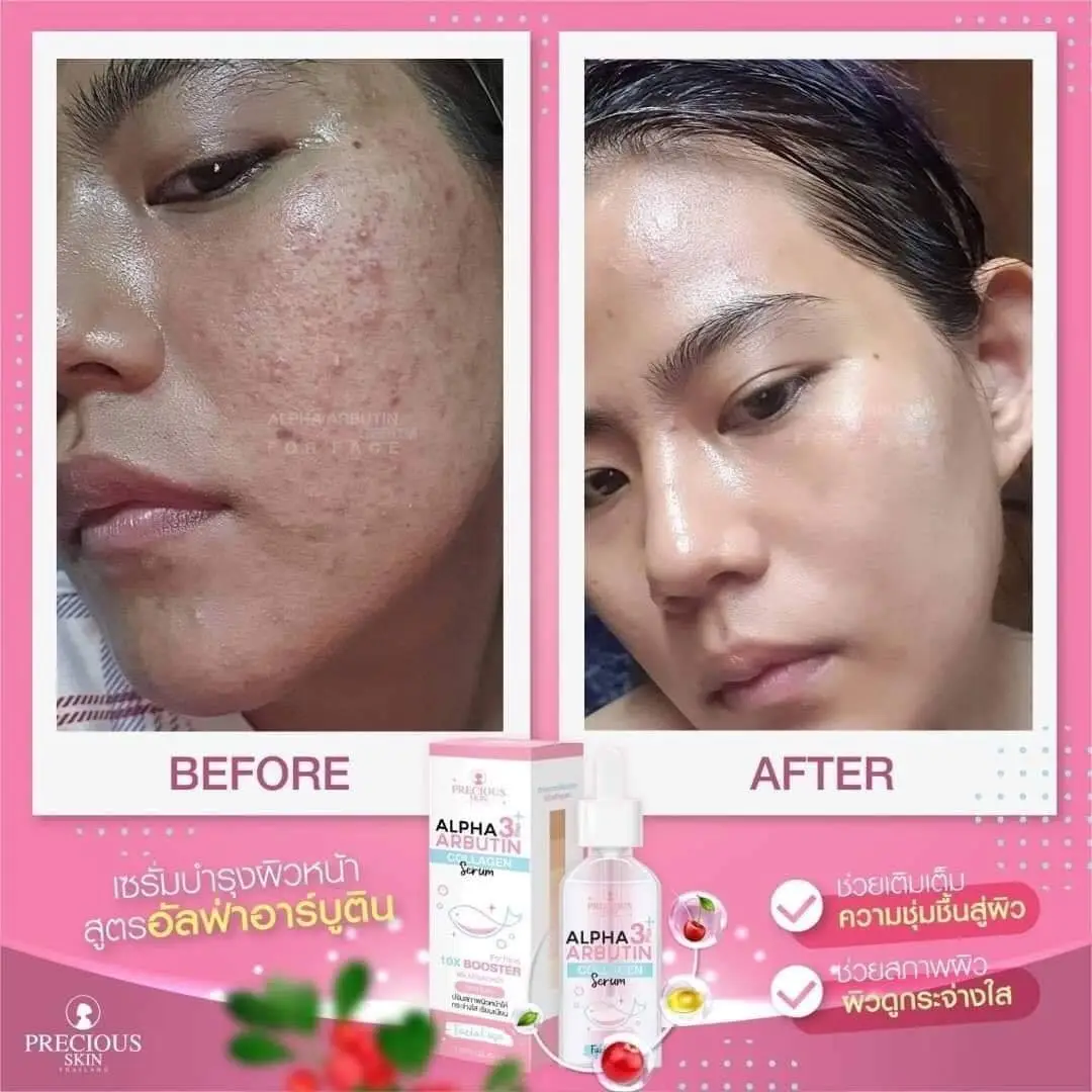 Picture of Precious Skin Alpha Arbutin Collagen Serum 50 ml