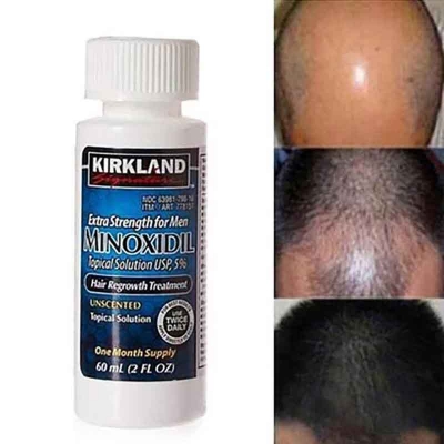 Picture of Kirkland Minoxidil 5% For Beard & Hair Growth NEW2025