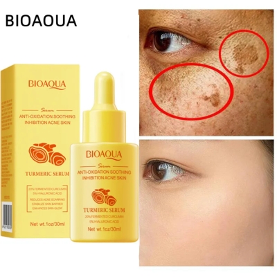 Picture of BIOAQUA Anti-oxidation Soothing Acne Removal Turmeric Face Serum- 30ml new