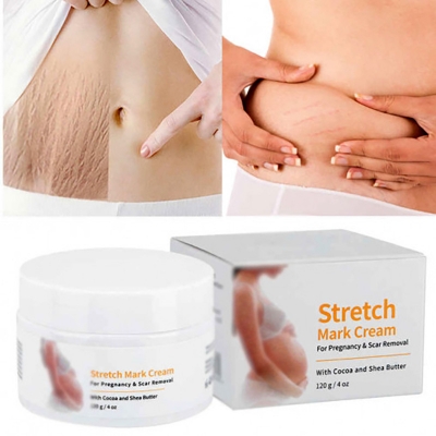Picture of MELAO Women Remove Pregnancy Scars Acne Cream Stretch Marks Treatment Maternity Repair Anti-Aging Body Creams-120gm new