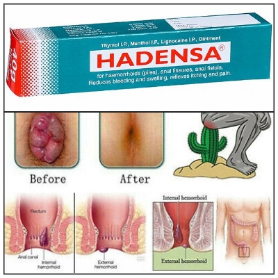 Picture of Indian Hadensa Ointment For Piles  Man & Women - 20gm