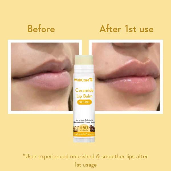Picture of WishCare Ceramide Lip Balm with SPF 50 PA+++ (Natural)