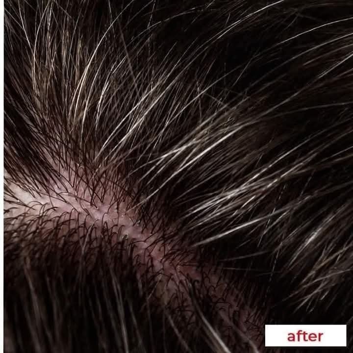 Picture of Nizoral 2% Ketoconazole Hair Care Anti-Dandruff Shampoo 100ml - Multicolor