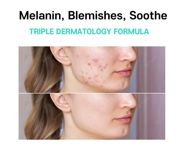 Picture of Melasma Treatment for Face Cream - Dark Spot Remover Centella Asiatica - Korean Skin Care Beauty Products 40ml