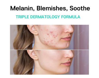 Picture of Melasma Treatment for Face Cream - Dark Spot Remover Centella Asiatica - Korean Skin Care Beauty Products 40ml