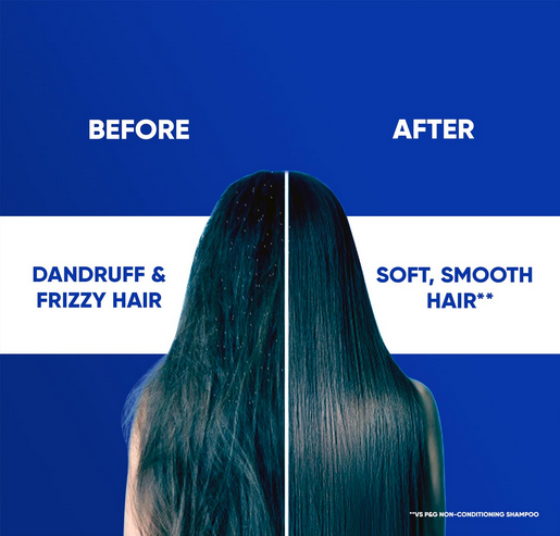 Picture of Head & Shoulders 2-in-1 Smooth and Silky Anti Dandruff Shampoo + Conditioner for Women & Men, With Almond Milk (1 L)