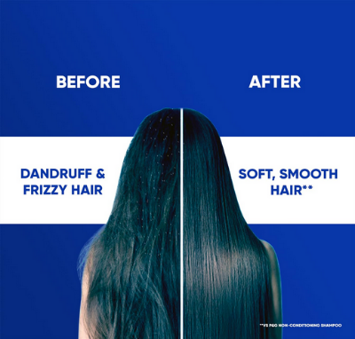 Picture of Head & Shoulders 2-in-1 Smooth and Silky Anti Dandruff Shampoo + Conditioner for Women & Men, With Almond Milk (1 L)