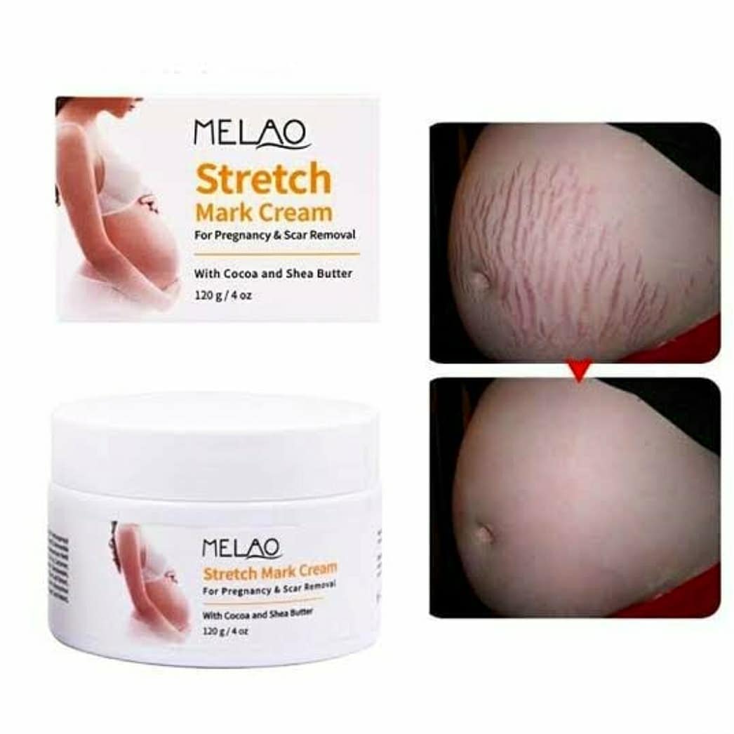Picture of Melao Stretch Mark Cream For Pregnancy And Scar Removal Treatment With Cocoa And Shea Butter Belly Moisturizer-120gm