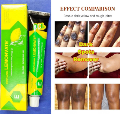 Picture of Lemonvate Cream 30 Gm