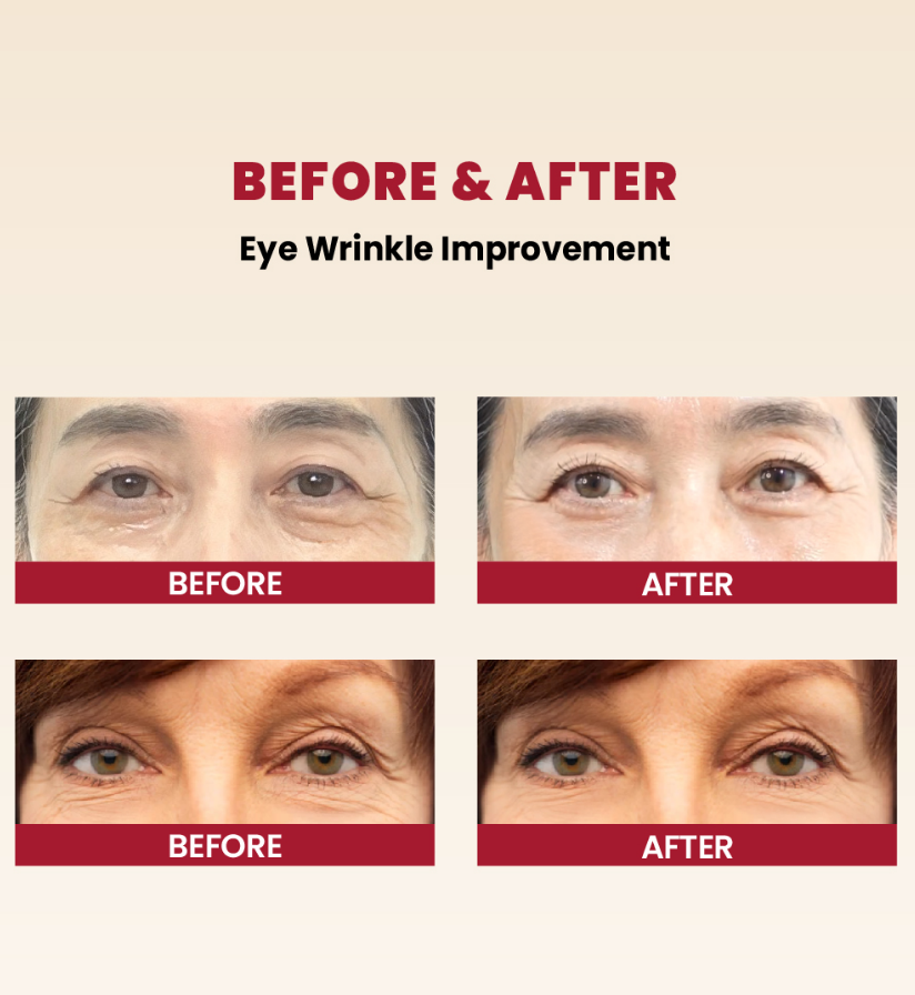 Picture of KSECRET SEOUL 1988 EYE CREAM : RETINAL LIPOSOME 4% + FERMENTED BEAN 30ML
