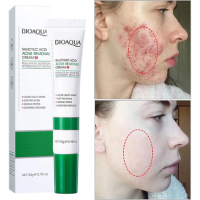 Picture of BIOAQUA Natural Salicylic Acid for Acne Face Cream Cleaning Pores Repairing Acne Spots Controlling Moisturizing Skin Remove Acne Marks-20gm