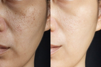Picture of Milk Soothing Gel 99% (Korean) For All Type Skins