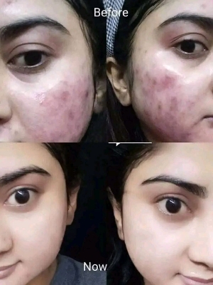 Picture of Collagen Plus Vitamin E Day & Night Cream - 40gm