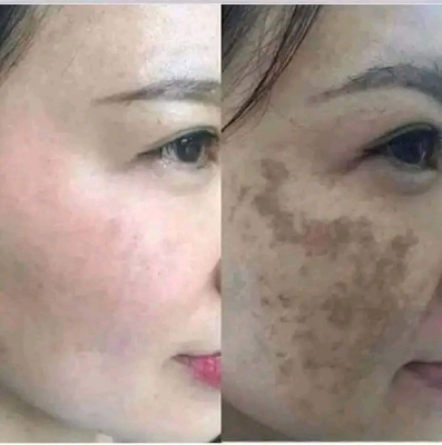 Picture of The Ordinary Niacinamide 10% + Zinc 1%-30ml