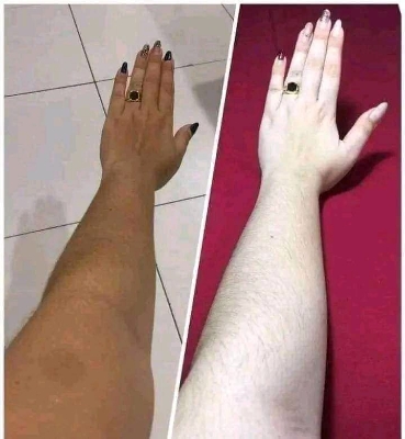 Picture of AVOSKIN Lilyum Body Whiten Cream - 300gm