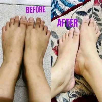 Picture of Kem Cot Thai Emergency Whitening Body Cream - 300gm