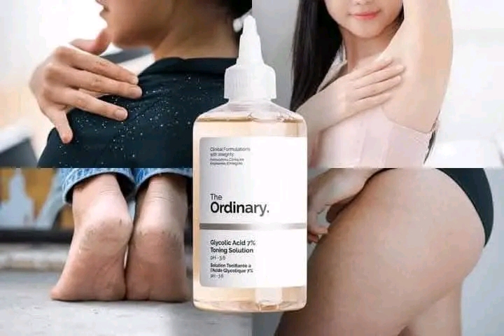 Picture of Glycolic Acid 7% Toning Solution-240ML