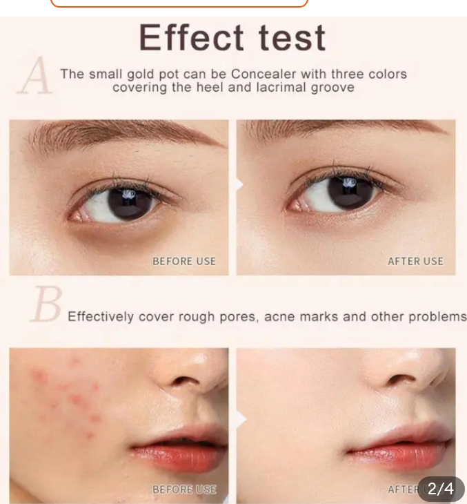 Picture of Sweet Mint Conceal Tri -Colour Concealer Palette Of Covers Acne Marks Dark Circles
