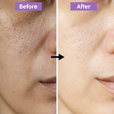 Picture of Gluta Collagen Pink Emergency Whitening Night Cream