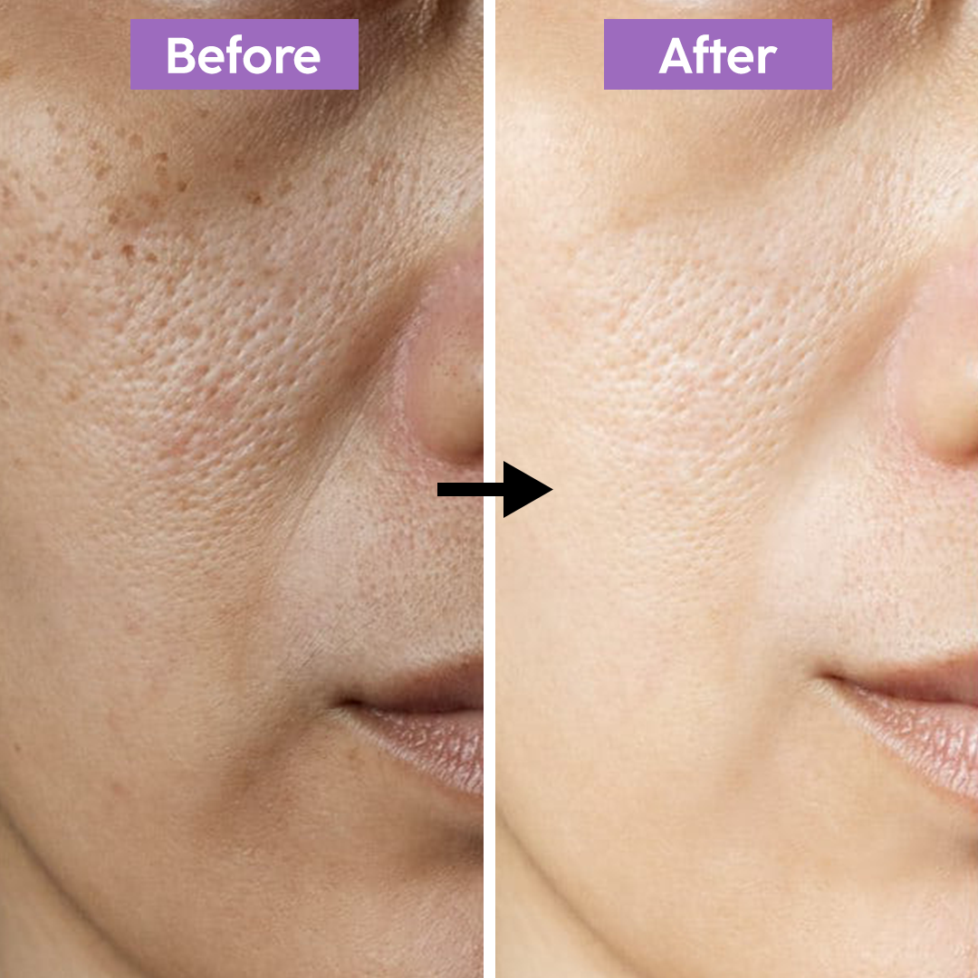Picture of Froza Fiber Detox Whitening Face Pack - 300gm