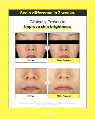 Picture of Tiam Vita B3 Source Serum 40 ml