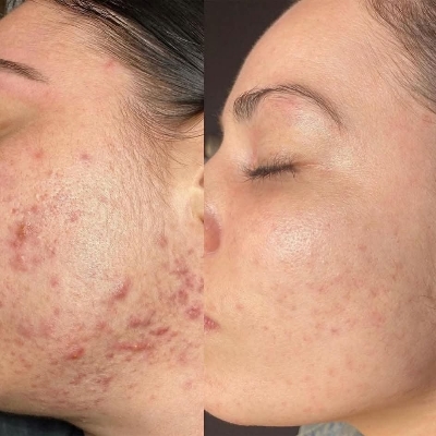 Picture of Original Dr. Althea 345 Relief Cream 50ml (Korea)