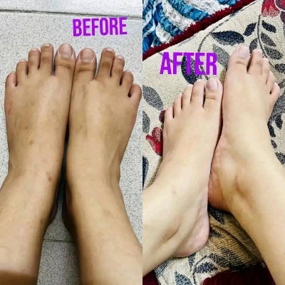 Picture of Authentic Kem Cot Thai Whitening Body Cream