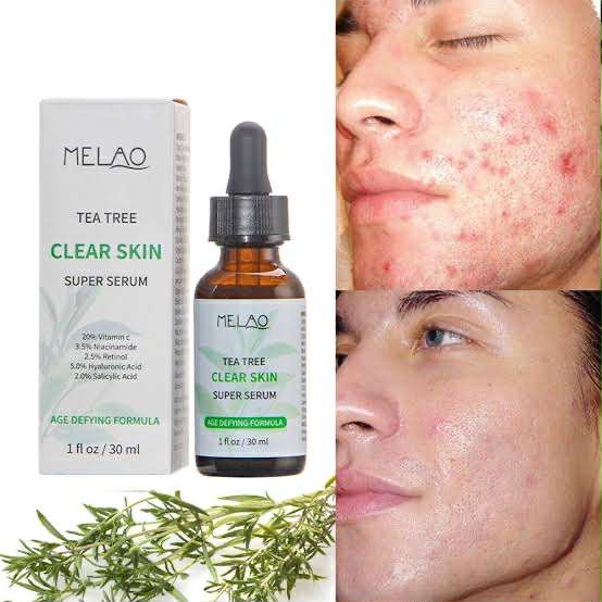 Picture of Melao Tea Tree Clear Skin Serum – 30 ml