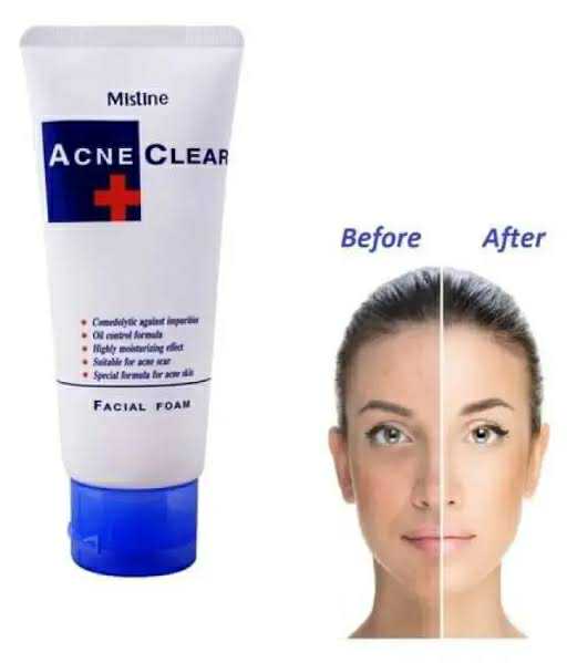 Picture of Mistine Acne Clear Facial Foam Face Wash - 85Gm (Made In Thailand) - Face Wash