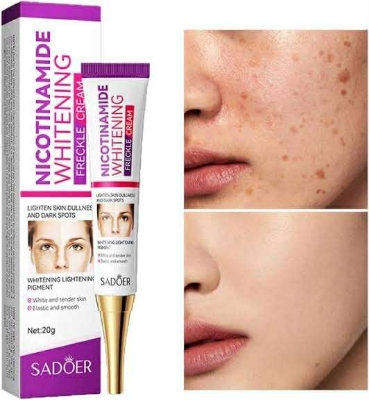 Picture of SADOER Niacinamide Whitening Freckle Cream Effectively Removes Melasma Lightens Black Spots Acne Marks Brightens Skin Care-20gm