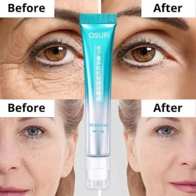 Picture of Osufi Anti Wrinkle Massage Eye Cream Reduces Eye Wrinkles Removes Bags Dark Circles Moisturizes Skin Beauty Health Eye Essen