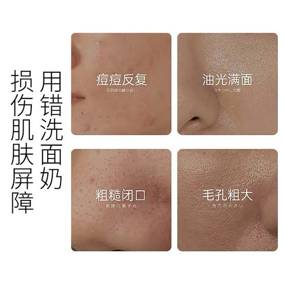 Picture of OSUFI Vitamin B5 Salicylic Acid Brighten Deep Cleansing Pores Melanin Removal Oil Control Moisturizing Gentle Face Wash Skincare