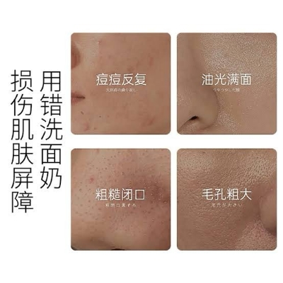 Picture of OSUFI Vitamin B5 Salicylic Acid Brighten Deep Cleansing Pores Melanin Removal Oil Control Moisturizing Gentle Face Wash Skincare