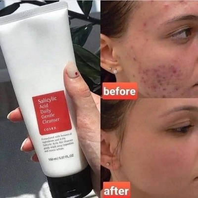 Picture of COSRX Salicylic Acid Daily Gentle Cleanser, 50 ML