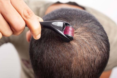 Picture of Derma Roller 540 Titanium Micro Needles for Beard Growth and Hair Loss All Size Avaiable 0.5mm