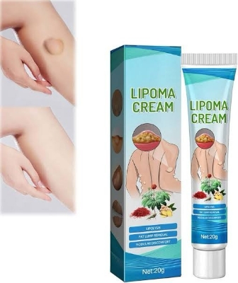 Picture of South Moon Lipoma Removal Cream Lipolysis Fat Lump Relieve Plaster Skin Swelling Ointment Subcutaneous Lumps Dredge Dissipate Body Care（20g）