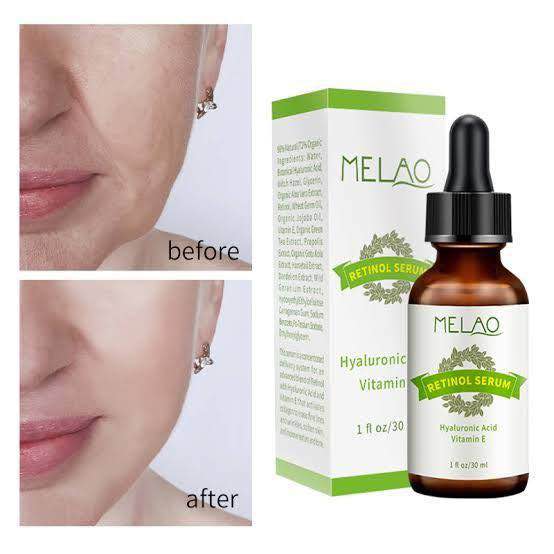 Picture of Melao Retinol Serum - Hyaluronic Acid Vitamin E-30ml