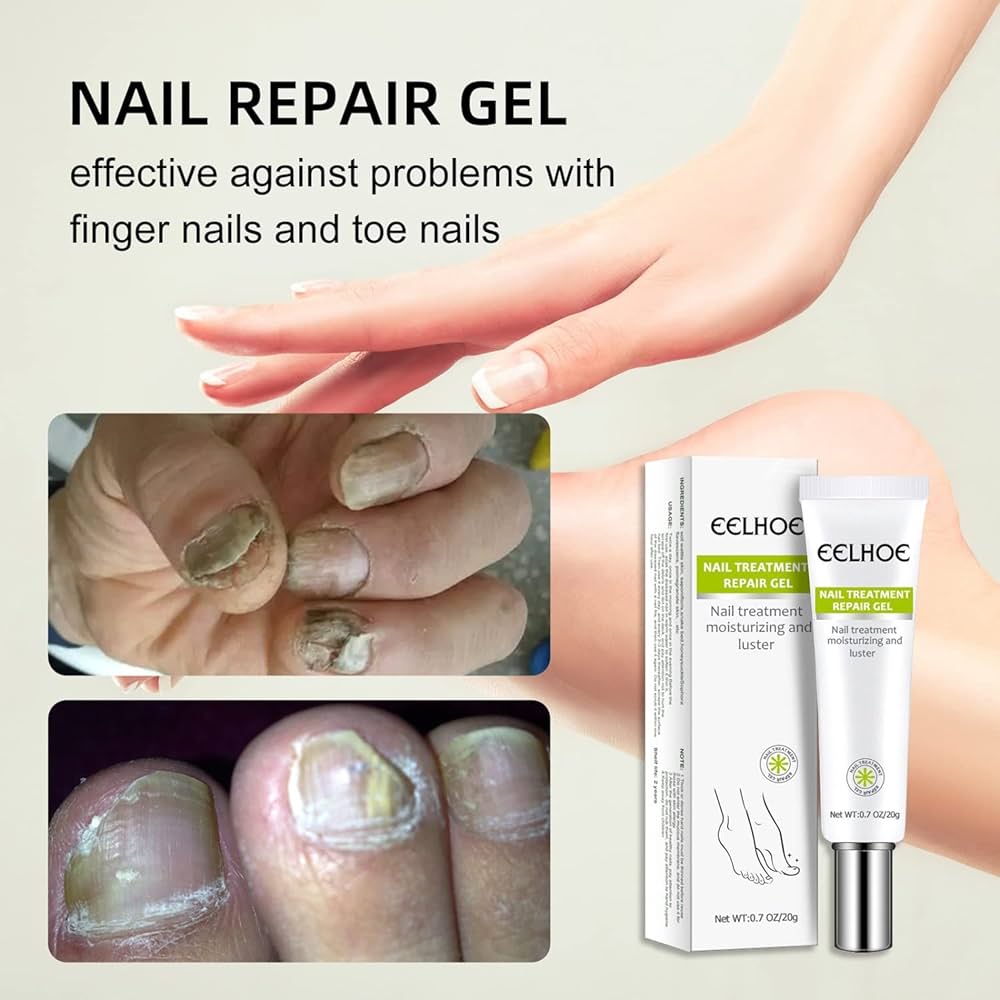 Picture of EELHOE Nail Fungus Repair Essence Gel Nail Treatment Repair Cream Gel-20gm