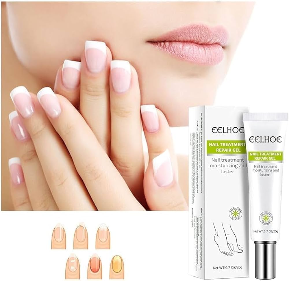 Picture of EELHOE Nail Fungus Repair Essence Gel Nail Treatment Repair Cream Gel-20gm