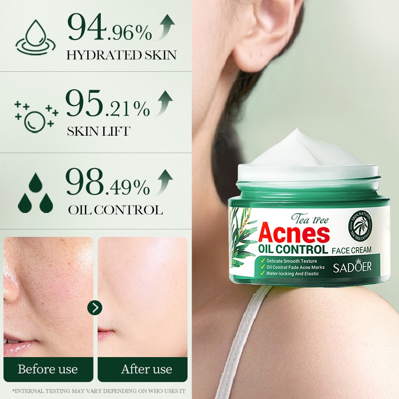 Picture of SADOER Facial Cream Acne Care Moisturizing Tea Tree Oil Acne Pimple Scar Removal Anti Acne for Face Skin Care - 50g
