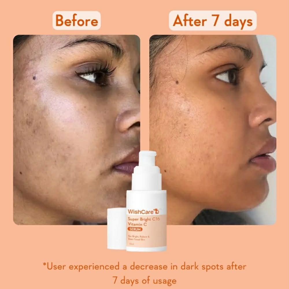 Picture of Wishcare Super Bright C16 Vitamin C Face Serum - 30 ml