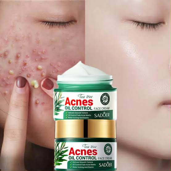 Picture of SADOER Facial Cream Acne Care Moisturizing Tea Tree Oil Acne Pimple Scar Removal Anti Acne for Face Skin Care - 50g
