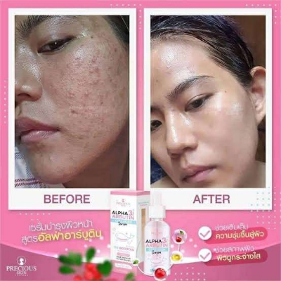 Picture of Precious Skin Alpha Arbutin Collagen Serum - 50ml (Thailand) (Next lavel cosmic)