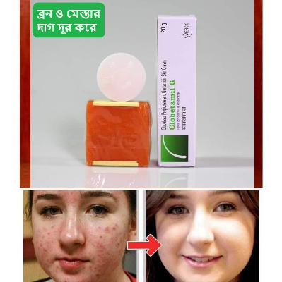 Picture of Clobetamil G Anti Freckles and Skin Whitening Cream 3in1 Set