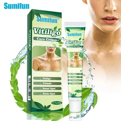 Picture of Sumifun Vitiligo Cream Reduces White Spots and Improves Skin Pigmentation