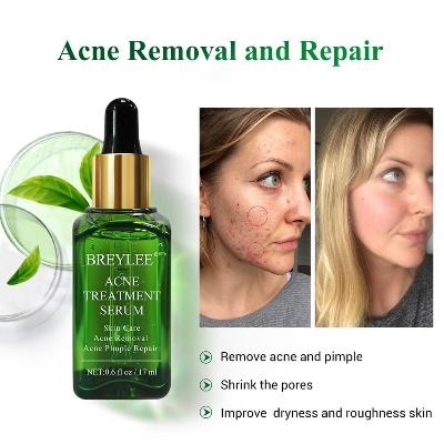Picture of BREYLEE Acne Treatment Cream and Serum( 20g +17ml) 